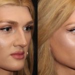 The Art of Facial Refinement