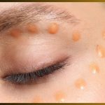 What Causes Hooded Eyes Over Time