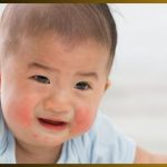 common baby rashes and when to call a doctor