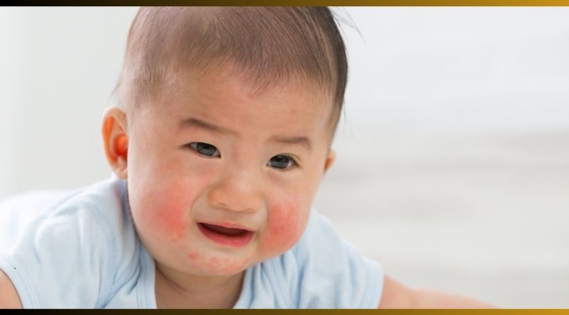 You are currently viewing Common Baby Rashes And When to Call a Doctor