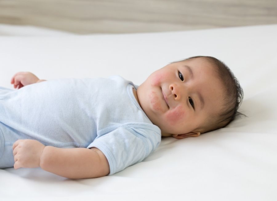 common newborn skin conditions and how to manage them