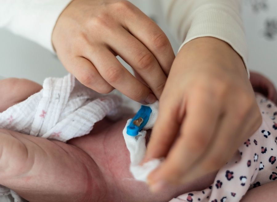newborn umbilical cord care do's and don'ts
