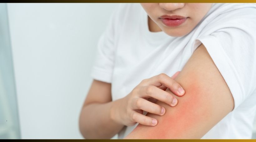 Understanding Heat Rash Causes, Symptoms, and Ayurvedic Remedies